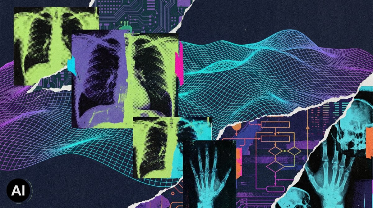 Only 9% of Radiologists See FDA-Cleared Mammography AI Reduce Biopsies